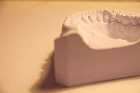 posterior view of dental cast made from blue stone plaster in orange lightの写真素材