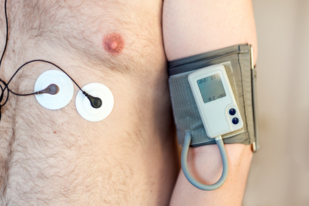 Holter monitor device and daily blood pressure recorder on human male body. Daily cardiogram monitoring. Overweight person. High risk of cardial disease. Health care and disease prevention.