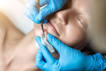 Close-up detail of beautician doctor hand in blue rubber protective gloves make blackhead spot...