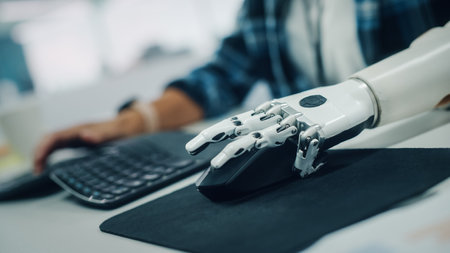 Inclusive Office: Person with Disability Using Prosthetic Arm to Work on Computer. Professional with...