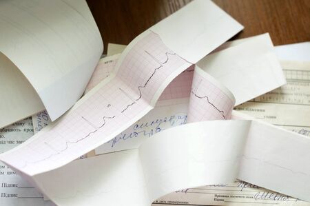 Cardiogram and medical history of the patient on a brown table doctorの写真素材
