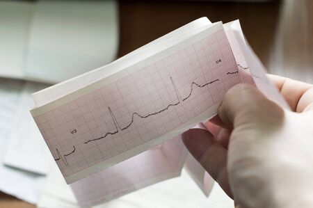 ECG of the patient in the doctor's hands against the background of an Office tableの写真素材