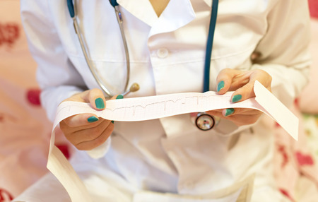 A doctor with a stethoscope and white coat checks a patient's cardiogramの写真素材