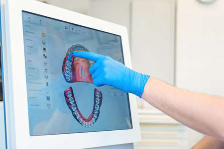 The dentist scans the patients teeth with a 3d scanner.