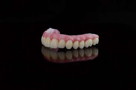 High-quality dental prosthesis made by dental technician, prosthesis with a pink gingiva to fix...