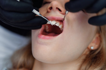 Dentist checks the condition of the patients gingivas with a dental probe. Diseases of the oral cavity, teeth care.の写真素材