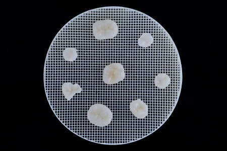 Metal free ceramic crowns of different teeth lying on a ceramic trigger stand.