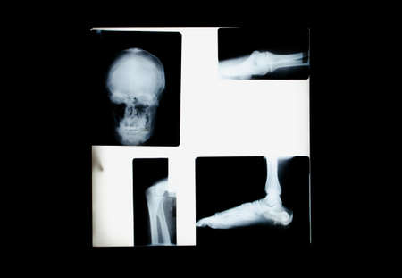 Extreme quality realistic  collage set of many X-rays shots. X-ray multiple part of adult peopleの写真素材