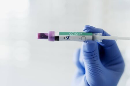 Positive medical result of coronavirus