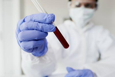 Technician holding a tube full of bloodの写真素材