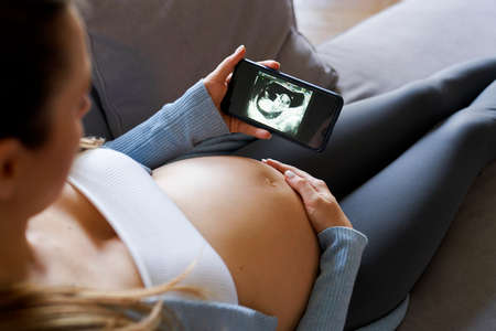 Pregnat woman chcecing online medical scans