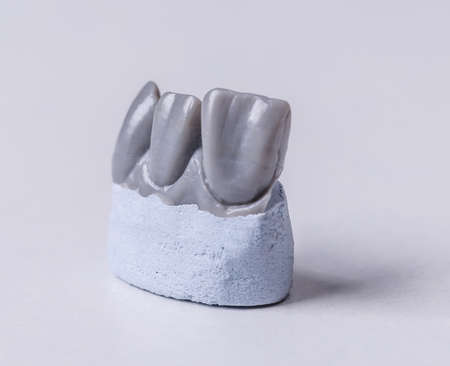 Artificial tooth, wax model on white backgroundの写真素材