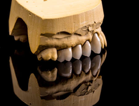 False teeth on gypsum jaw on black backgroundの写真素材