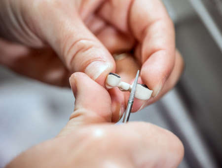 Dental technician working on dentures