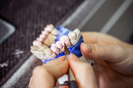 Dental technician working in dental laboratoryの写真素材