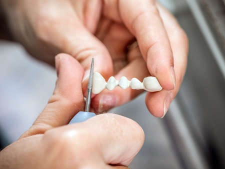 Dental technician molding teeth with a dental drillの写真素材