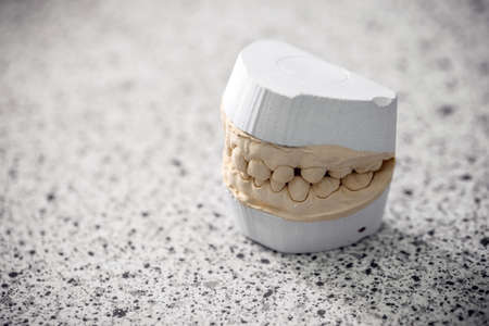 Gypsum model plaster of toothの写真素材