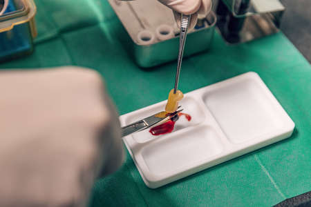 PRF platelet rich fibrin therapyの写真素材