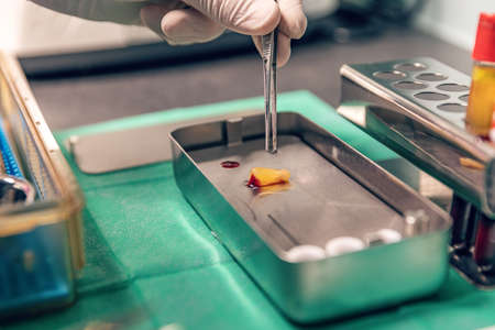 Platelet rich fibrin therapy PRF is an exciting new treatment that has achieved tremendous...