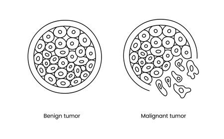 Benign and malignant tumor line icon in vector, illustration of oncology.のイラスト素材