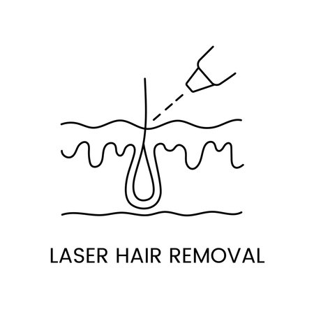 Epilation line icon in vector, illustration of hair in layers of skin for laser cosmetology clinicのイラスト素材