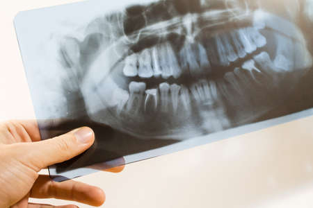 to study an x-ray of teethの写真素材