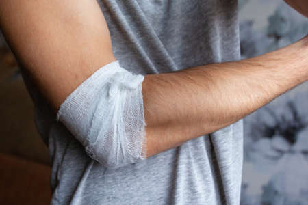 man's arm with bandaged elbowの写真素材