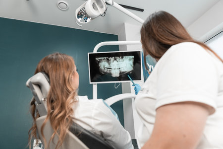 Installation of dental implants is carried out with high accuracy and taking into account the needs of the patient. The dentist carefully analyzes the X-ray of the oral cavity and discusses the treatment strategy with the patient.の写真素材