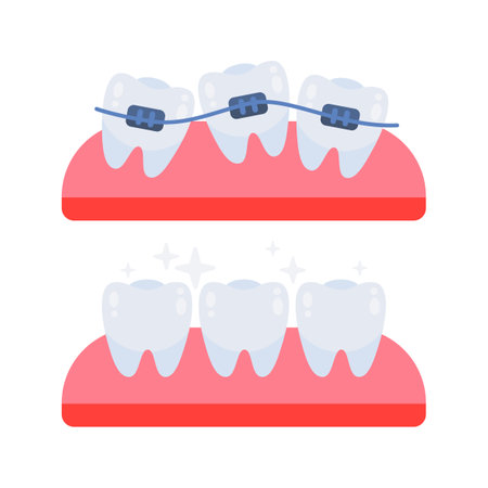 Teeth straightening with braces showing before and after stagesのイラスト素材