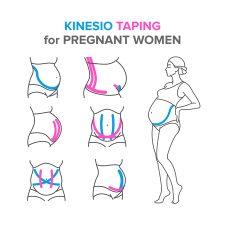 kinesio taping for pregnant womenのイラスト素材