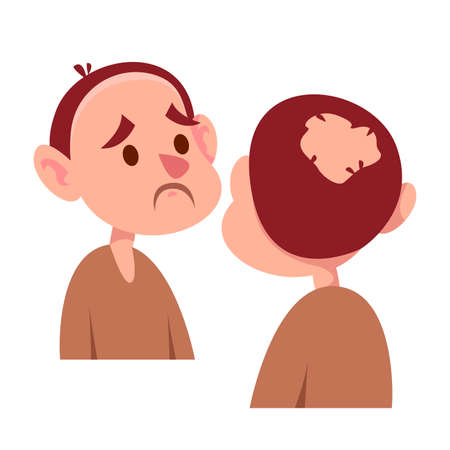 Bald sad man looks at his reflection. Set with a view of the head of the character speridi and from the back. Baldness problem. Vector character illustration in cartoon childish styleのイラスト素材