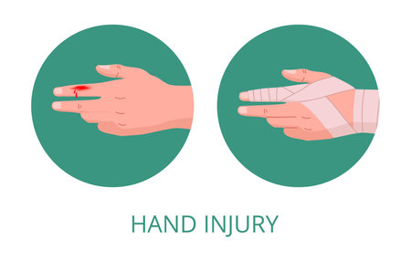 Injured human hand. Bandaged damaged arm, emergency treatment for skin cut flat vector illustration. Physical injury bandageのイラスト素材