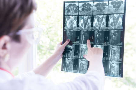Doctor at hospital examines nuclear magnetic resonance phothography of spine
