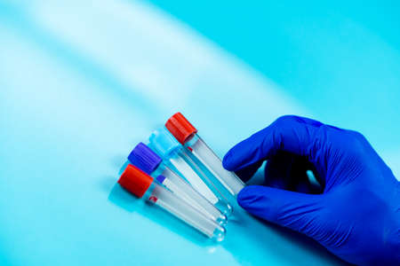 Hand wearing blue gloves holding bottles for samples used in hospitals or medicine for blood samples in a laboratory on a blue backgroundの写真素材