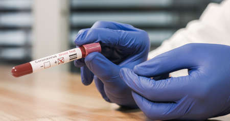 Doctor marking Coronavirus Positive on Blood test tube. Epidemic and Virus Outbreak.