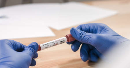 Coronavirus COVID-19 Infected Blood Sample in Doctor Scientist Hands. Epidemic and Virus Outbreak.