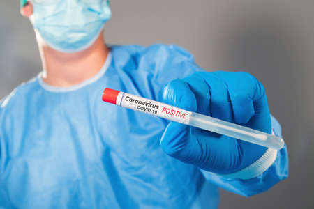 Virologist holding coronavirus swab test sample in a vial with gloves and face mask at laboratory. Close upの写真素材