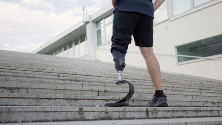 A man is ascending outdoor stairs using a prosthetic leg, showcasing determination and strength in his journey.の写真素材