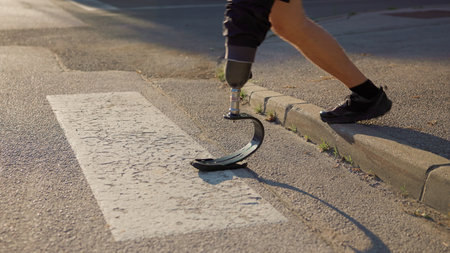 A person walks on a city street using a prosthetic leg, showcasing mobility and independence in everyday life.の写真素材