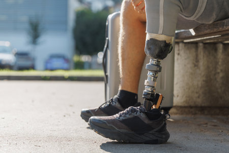 Traveler with a prosthetic leg sitting on the bench and working on a laptop, checking the time on the wrist watch while waiting for public transportation.の写真素材