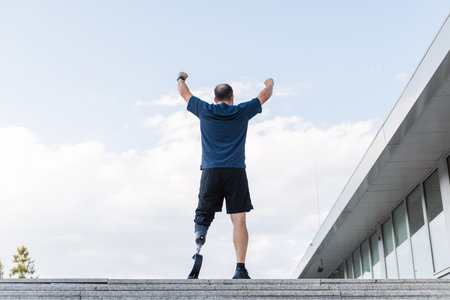 Man with a prosthetic leg raising arms in victory after successful running training up long street stairs. Disability, achievement, and motivation concept.の写真素材