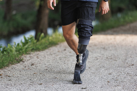 Man with a disability, using a versatile prosthetic leg, walking along the greenway during daily...