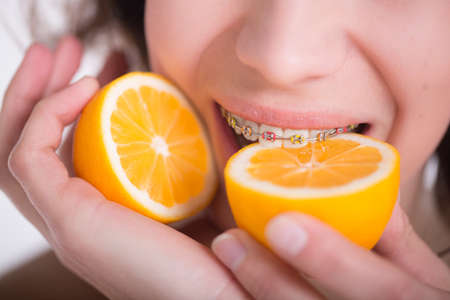 Girl with multi-colored braces tastes a lemon