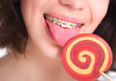 Close-up shot of girl with multicolored bracket systems and lollipopの写真素材