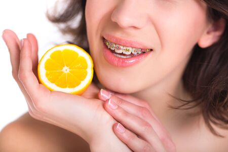 Beautiful girl with perfect skin and multi-colored braces posing with lemon on palmの写真素材