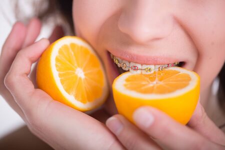 Beautiful girl with perfect skin and multi-colored braces posing with lemon on palmの写真素材