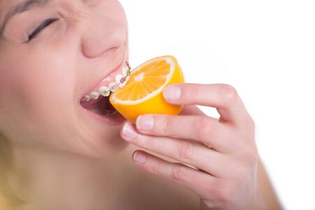 Beautiful girl with perfect skin and multi-colored braces posing with lemon on palmの写真素材