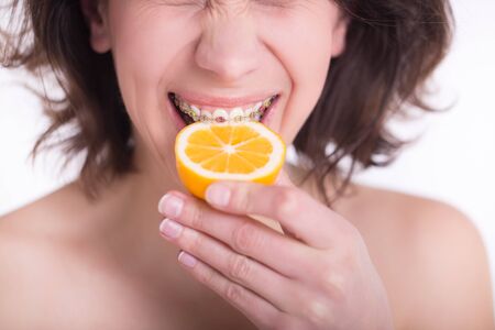 Beautiful girl with perfect skin and multi-colored braces posing with lemon on palmの写真素材