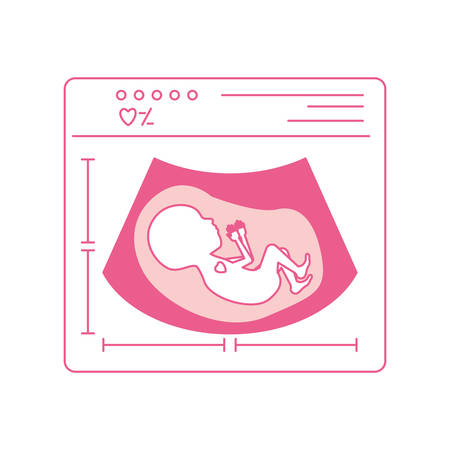 pink silhouette of ultrasound of baby vector illustrationのイラスト素材