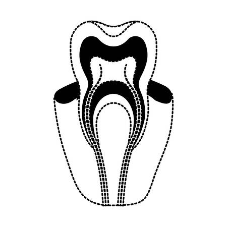 tooth with nerve and root view in black dotted silhouette vector illustrationのイラスト素材
